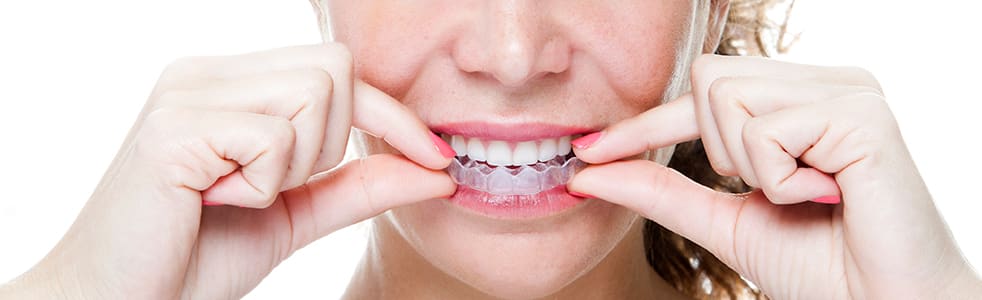 Invisalign Provider in Port Hawkesbury